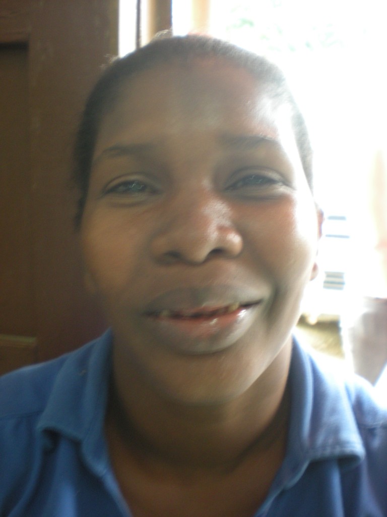 Joana before her flouride treatment